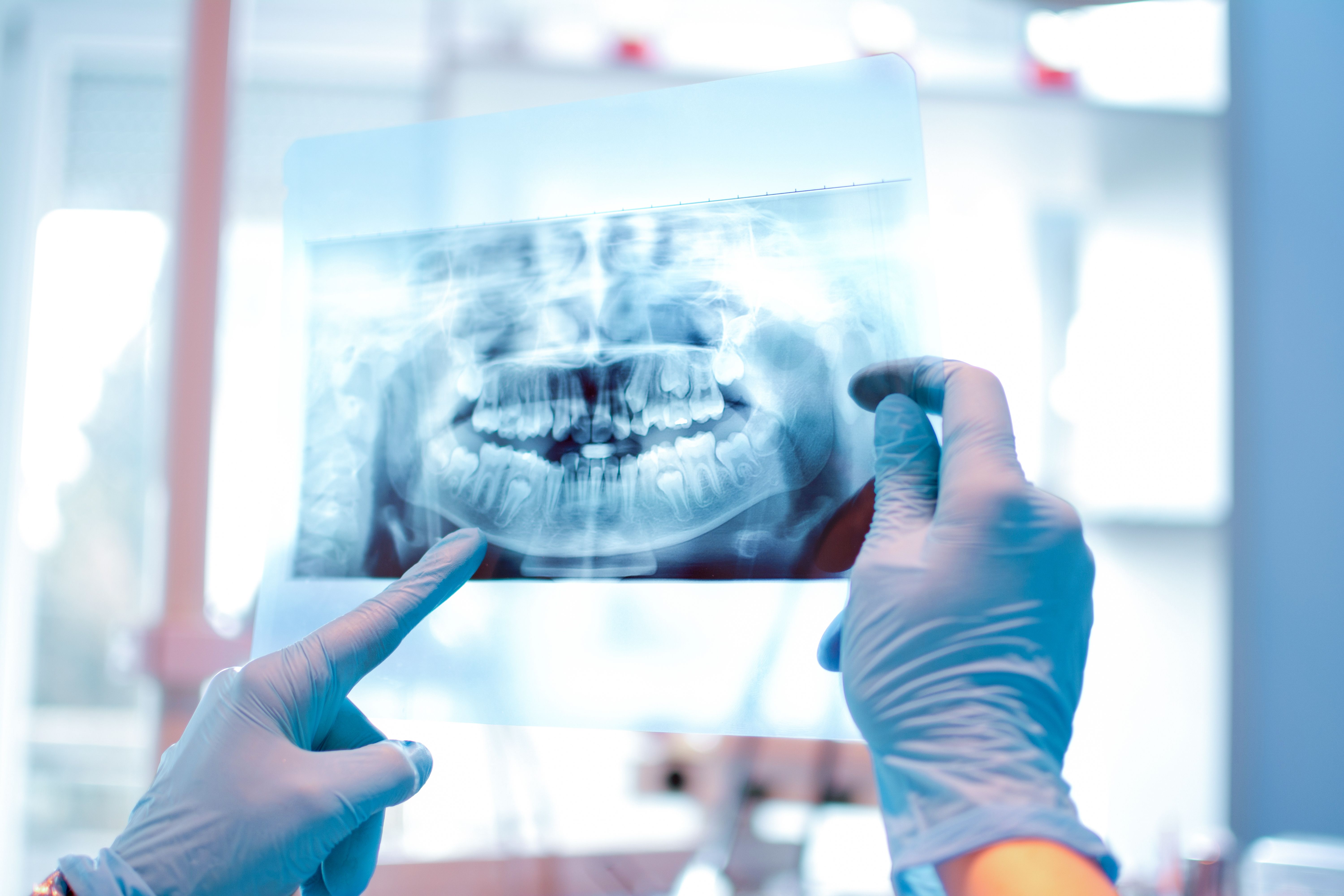 Dentist looking at dental x-ray